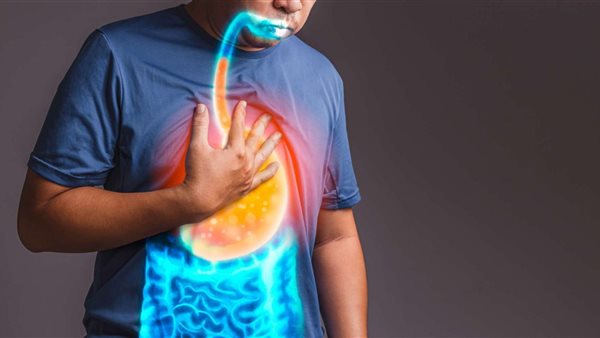 الصحة تحذر: ارتجاع المريء مرض خطير يتطور إلى سرطان الحنجرة