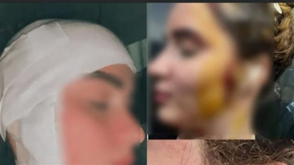 19 فبراير أولى جلسات محاكمة المتهم بتشويه وجه فتاة بـ 49 غرزة في العجوزة