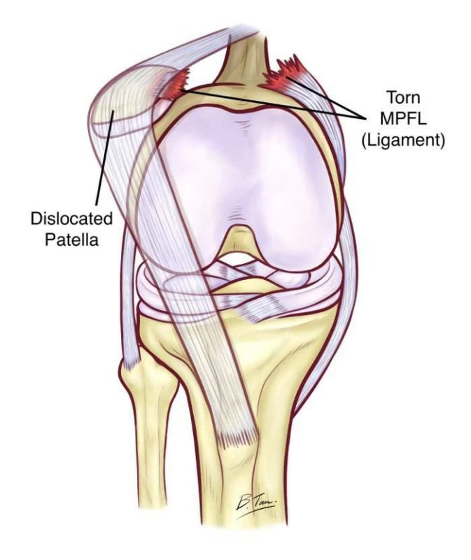 الشهراني يكشف تفاصيل إصابة اللاعب حمد اليامي