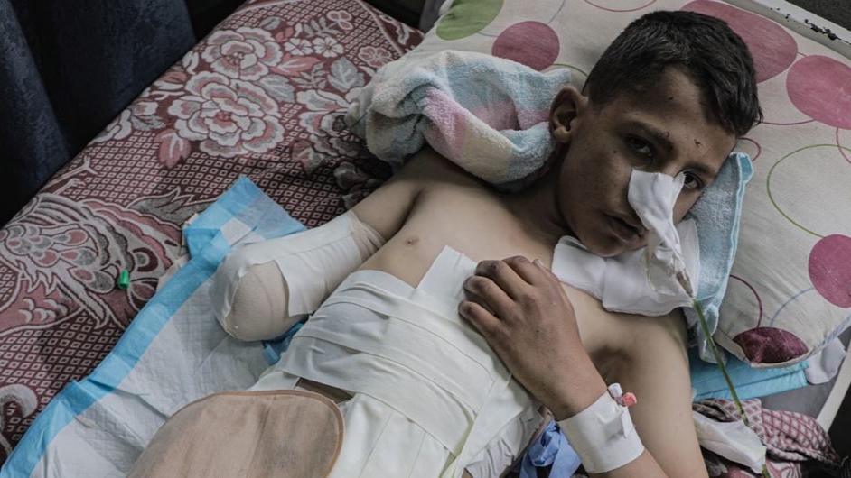 الأمم المتحدة تحذّر: أطفال غزة والضفة يدفعون ثمناً باهظاً للحرب والعنف