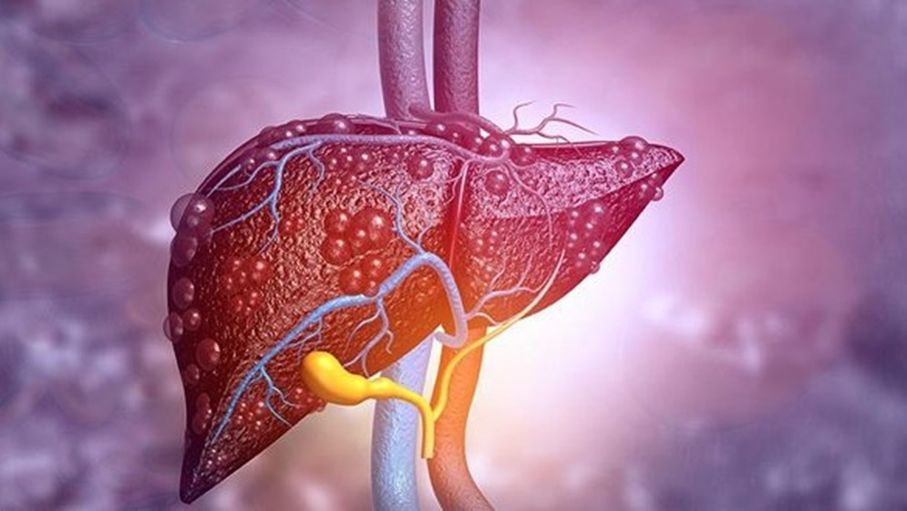 العناية بالأسنان تقلل خطر الإصابة بسرطان الكبد بنسبة 27%