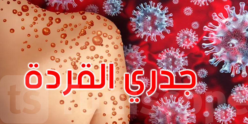 جريمة بيولوجية.. عالمان أميركيان متهمان بنقل فيروس جدري القردة