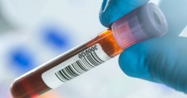 تطوير اختبار دم يعتمد على الليزر للكشف المبكر عن السرطان