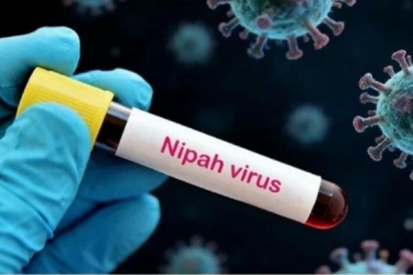 تحرك حكومي نحو مواجهة فيروس نيباه باشتراطات استيراد مشددة