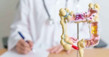 ما العمر المناسب لأول منظار للقولون للكشف عن السرطان