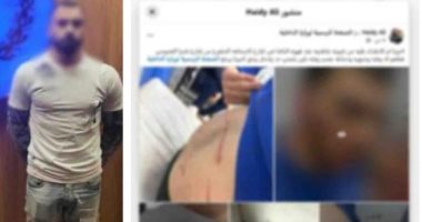 خناقة أولوية مرور تنتهي بجرح قطعي في وجه طالب.. والأمن يضبط المتهم بالساحل