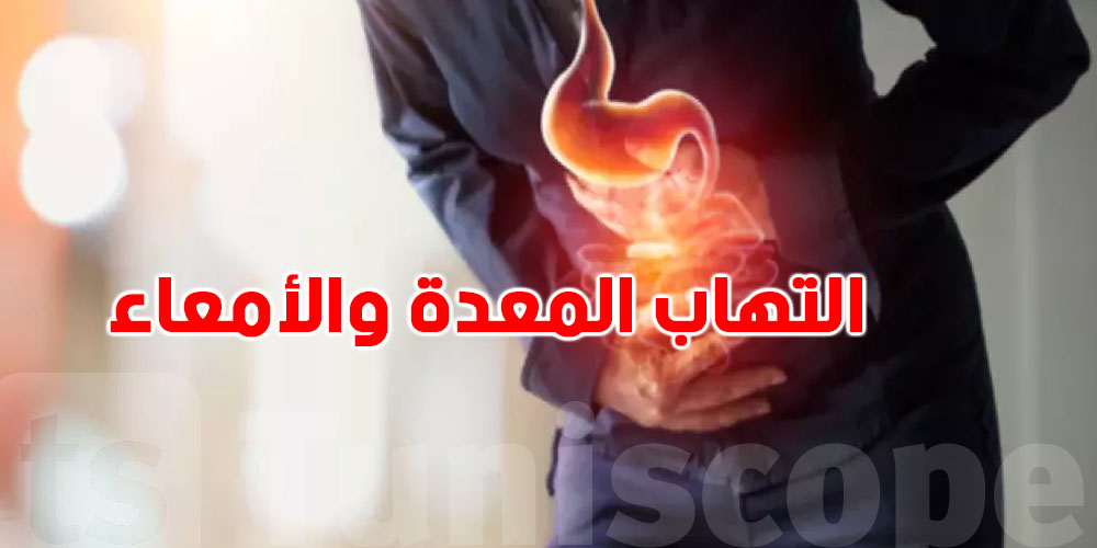 أبرز أعراض التهاب المعدة والأمعاء التي لا يجب تجاهلها