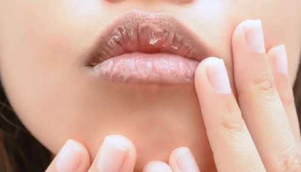 وصفات طبيعية فعّالة لعلاج اسمرار الشفاه واستعادة لونها الوردي