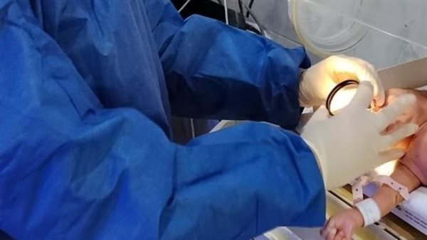 رمد المنصورة تنتقل إلى "حضانات طلخا" لإنقاذ عيون الأطفال المبتسرين