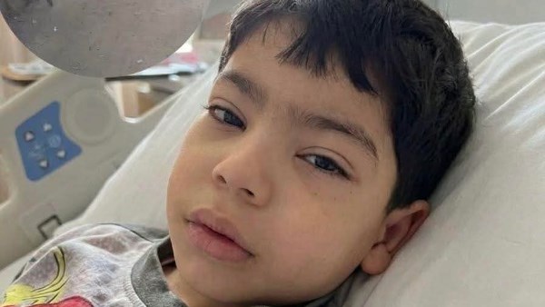 أكثر من 19 ساعة.. خروج طفل باسوس من العمليات بعد إجراء جراحة كبرى