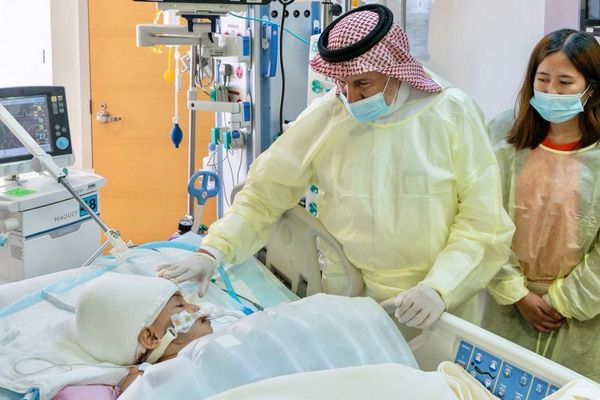 استقرار حالة التوأم الفلبيني "كليا وموريس آن"