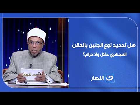 هل تحديد نوع الجنين بالحقن المجهري حلال ولا حرام؟ .. الشيخ يوضح الحكم الشرعي بالتفصيل