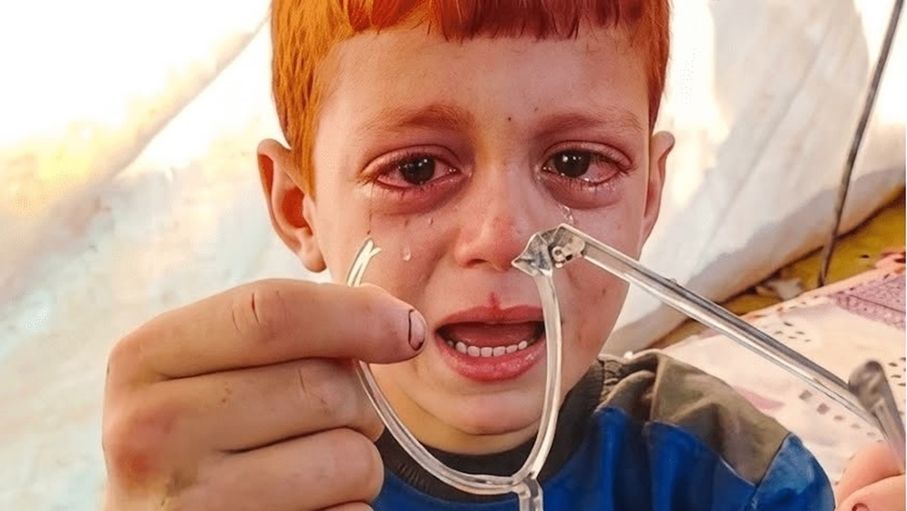 طواقم عملية "الفارس الشهم 3" تلبي نداء الطفل الغزيّ "أيوب" (فيديو)