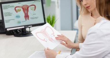 مؤتمر علمى يغير اسم متلازمة تكيس المبايض