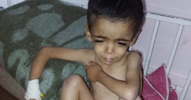 بعد وفاة شقيقه بالمرض ذاته.. ياسر عرفات يصارع سوء التغذية والسيلياك في غزة