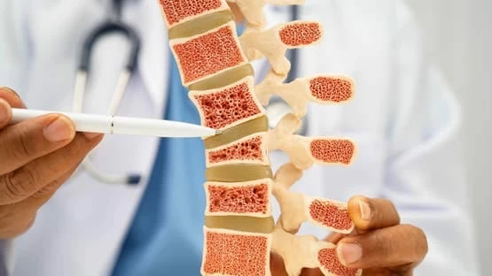 6 أطعمة تحميك من هشاشة العظام مع التقدم في العمر