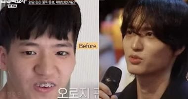 كورى ينفى خضوعه لجراحة تجميل رغم تحول مظهره المذهل