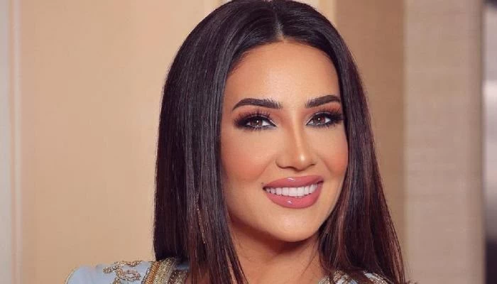 ديانا حداد تنفي شائعات التجميل وتؤكد