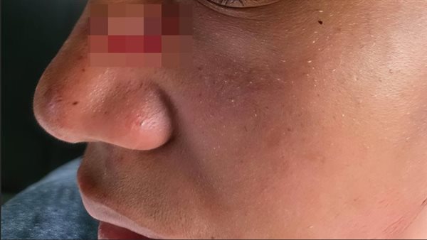 ناداه باسم أمه، تفاصيل مثيرة حول اعتداء طالب على زميله بـ"كتر" أمام مدرسة في الجيزة (صور ومستندات)