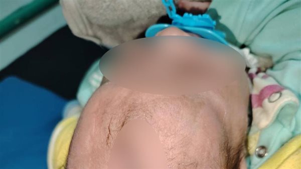 عملية جراحية دقيقة تنجح في إنقاذ حياة رضيع بمستشفى جامعة الأزهر بدمياط الجديدة (صور)