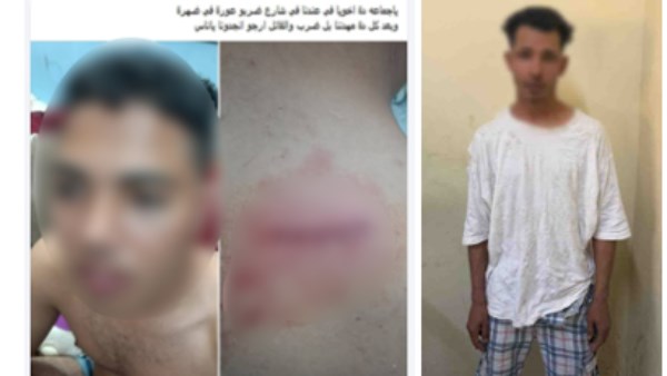 بسبب خلافات الجيرة.. ضبط عاطل تعدى على شاب وأصابه بالجيزة