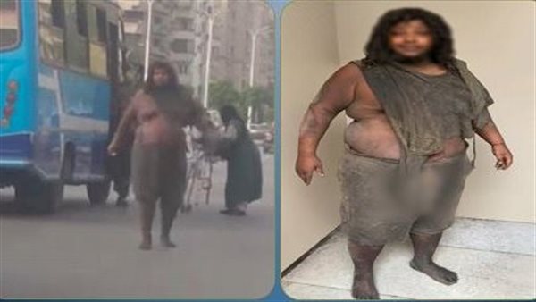 أخبار الحوادث اليوم: القبض على مهتز نفسيًا اعتدى على المارة بمصر الجديدة.. تفاصيل ضبط سيدة تقدم مخلفات لحوم للكلاب الضالة.. إصابة 5 أشخاص في حادث تصادم بالفيوم