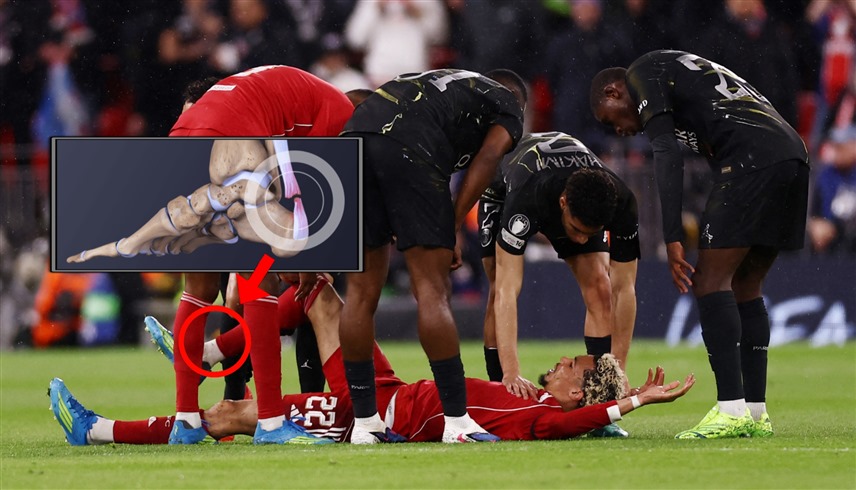 "وتر العرقوب" ينهي موسم إيكيتيكي ويحرمه من المونديال