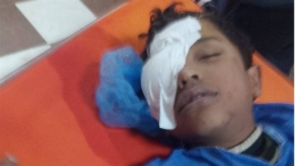 تعليم المنوفية تحيل واقعة فقد طالب لإحدى عينيه داخل مدرسة إلى التحقيق