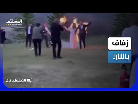 عريس وعروسة في تركيا يشعلان النار في ملابسهما يوم الزفاف!