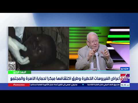 أستاذ فيروسات: السل الرئوي والتيفود يعودان بتوحش.. و3 جواهر مناعية تنمو بجسدك بهذا الشرط