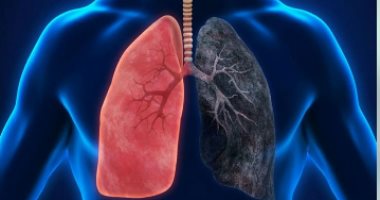 عدوى الرئة الفطرية الصامتة.. ما هو داء الرشاشيات