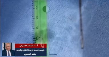 تفاصيل إنقاذ طفل عمره 11 عاما من "مسمار فى القلب" طوله 5 سم بقصر العينى