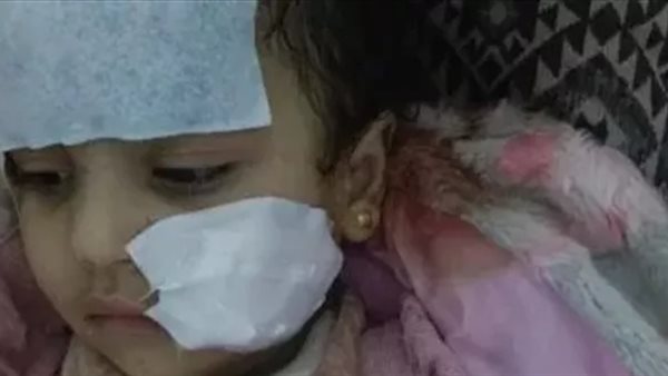 إخلاء سبيل لوبا الحلو فى واقعة تعرض طفلة لهجوم أسد