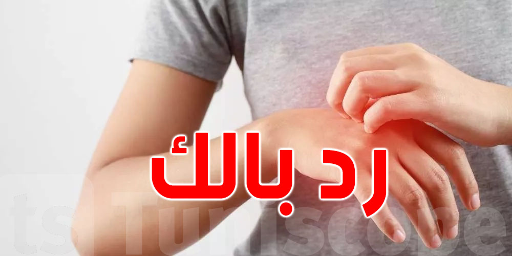 حكّة في جلدك؟ ممكن تكون علامة أخطر مما تتصوّر!
