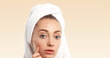 8 وصفات طبيعية لعلاج أشهر مشاكل البشرة.. من الهالات لحب الشباب
