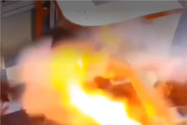 بطارية هاتف تنفجر داخل فم طفل وتصيبه بجروح.. ماذا حدث؟