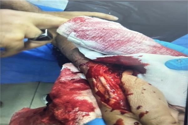 البحث عن المتهمين بالتعدي على شاب بسلاح أبيض بحلوان