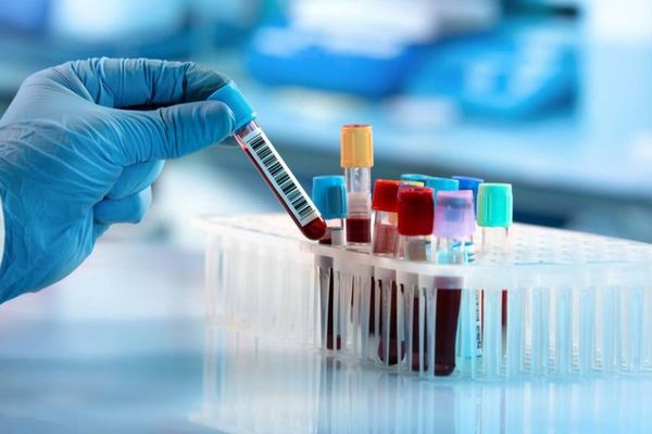 رابط محتمل بين فقر الدم وزيادة خطر السرطان