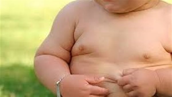 17 % من أطفال مصر يعانون، اقتراح برلماني بإطلاق استراتيجية وطنية لمكافحة السمنة