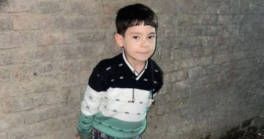 دعواتكم بنجاح العملية.. طفل باسوس يجرى جراحة بمستشفى معهد ناصر لمدة 13 ساعة