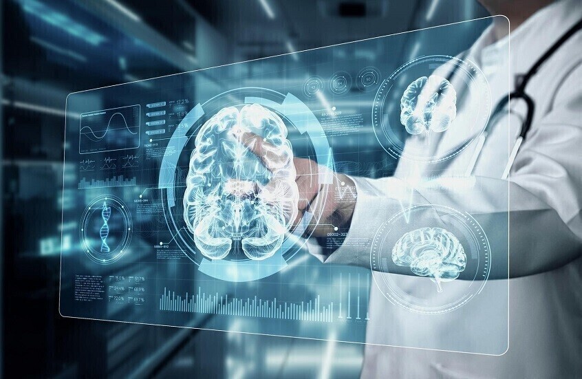 أطعمة تزيد خطر الإصابة بالسكتة الدماغية