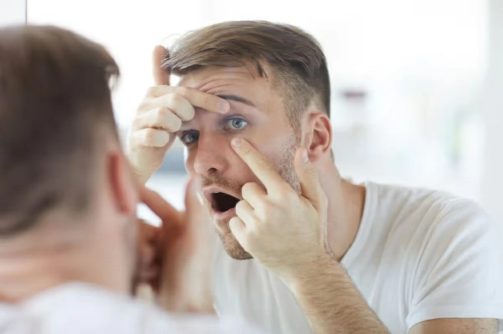 كيف تتخلص من احمرار العين.. ومتى يستدعي زيارة الطبيب؟