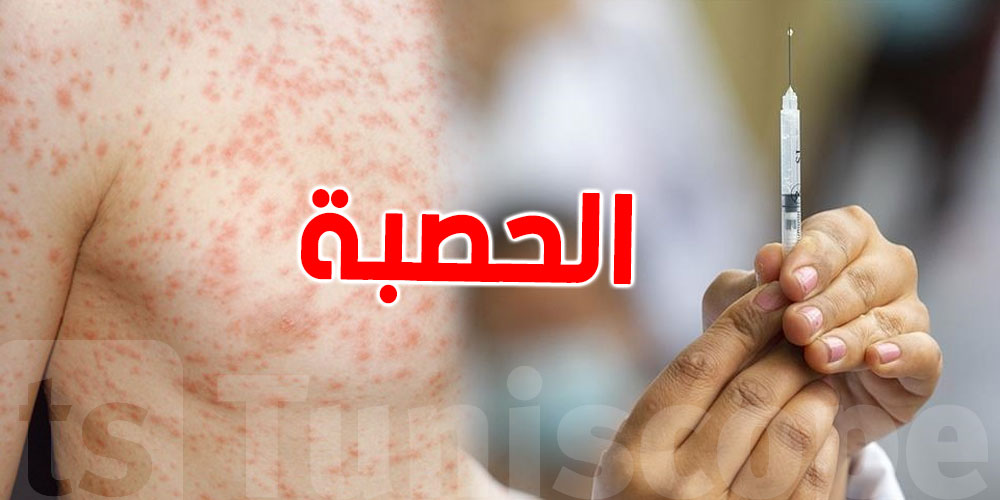 منظمة الصحة العالمية تحذر: لا تهاون في التلقيح ضد الحصبة