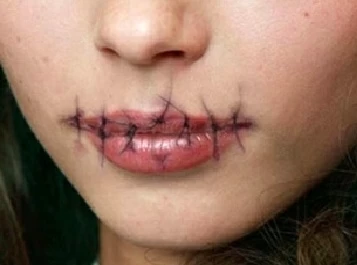 بإبرة وخيط.. يابانية تخيط شفتي جارتها لمنعها من الكلام!