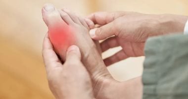 مرضى النقرس.. طرق صحية لتناول اللحوم دون نوبات ألم