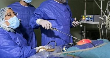 مستشفى أطفال بنها ينجح فى علاج طفلة من فرط التعرق بتقنية جراحية متقدمة