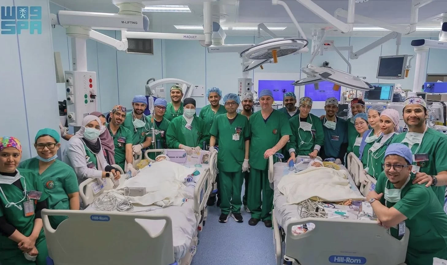 الفريق الطبي والجراحي يستكمل عملية فصل التوأم الملتصق الفلبيني «كليا وموريس آن»