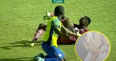 إصابة مأساوية للبرازيلي روماريو دا سيلفا في الدوري الهندوراسي