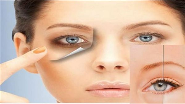الهالات السوداء مع السهر والمذاكرة، حلول منزلية فعالة لاستعادة نضارة عينيك
