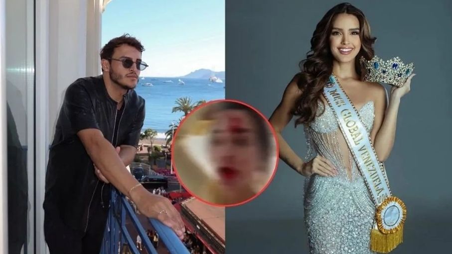 بكدمات على وجهها.. ملكة جمال فنزويلا تتهم مصفف شعر بضربها في كان